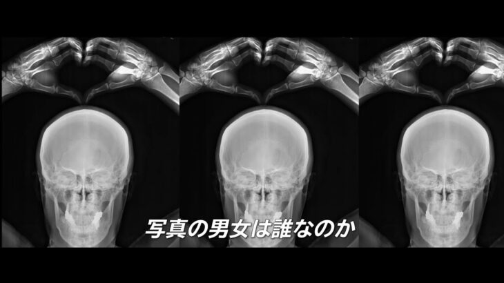 男女の恥ずかしいレントゲン写真　病院で盗撮事件発生　恋愛群像劇　映画「なまず」予告